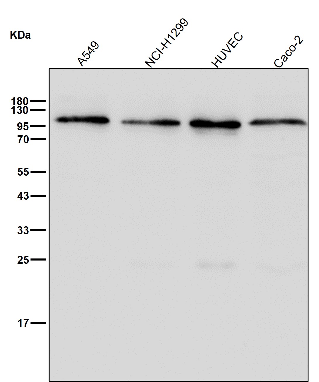 Ena/VASP-like Ab