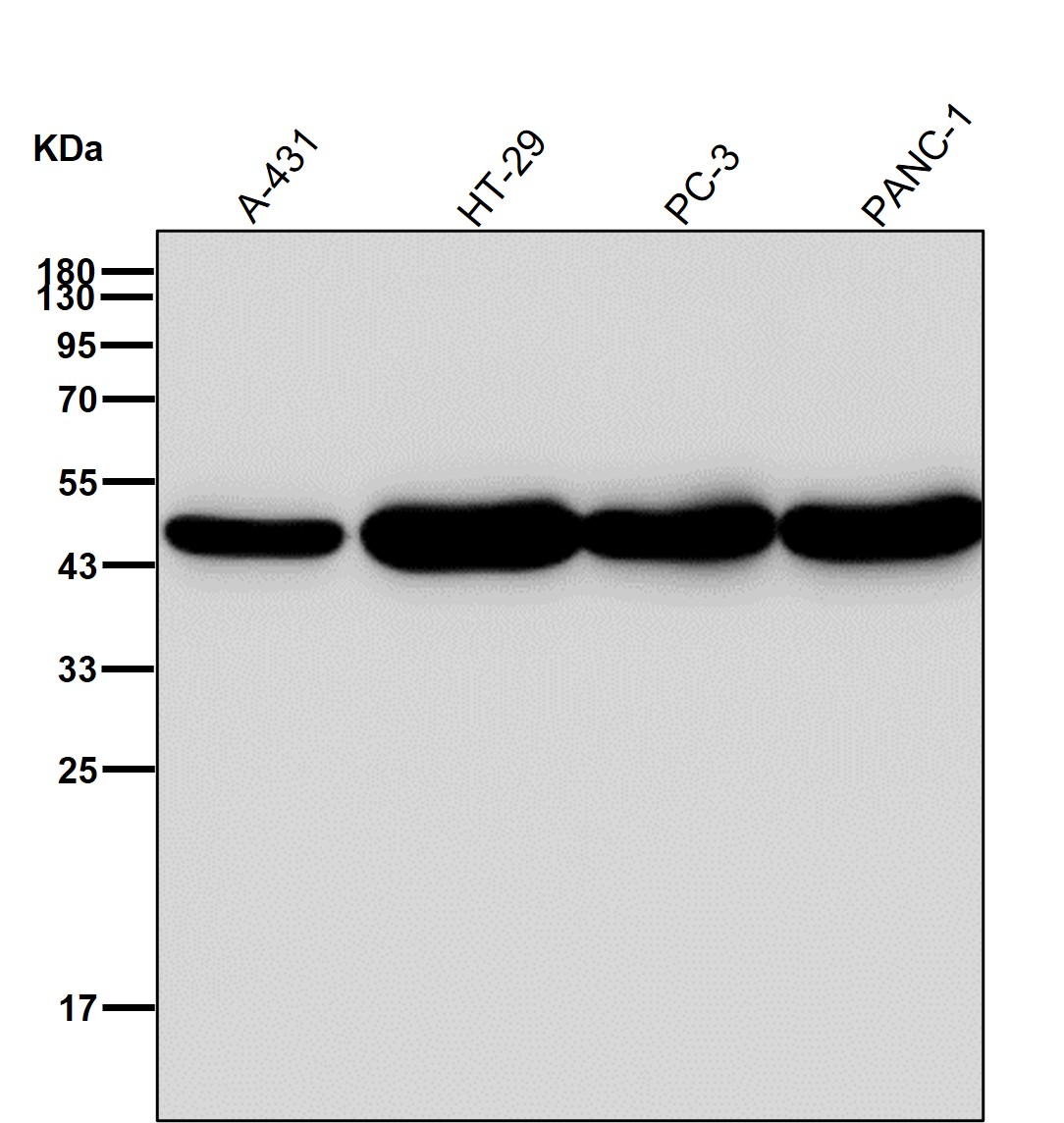 Cytokeratin 18 Ab