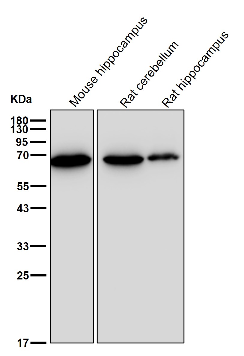 alpha Internexin Ab