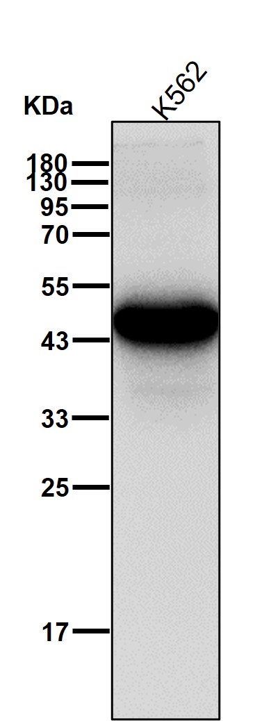 Cytokeratin 18 Ab