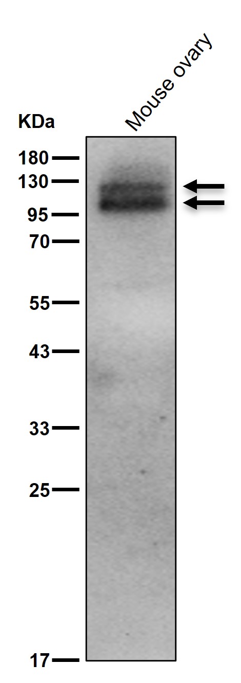 Androgen receptor Ab