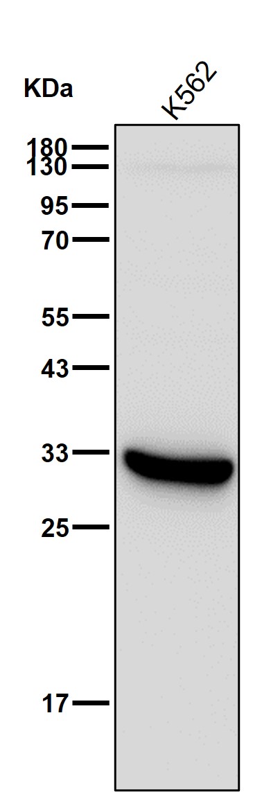 Carbonic anhydrase 1 Ab