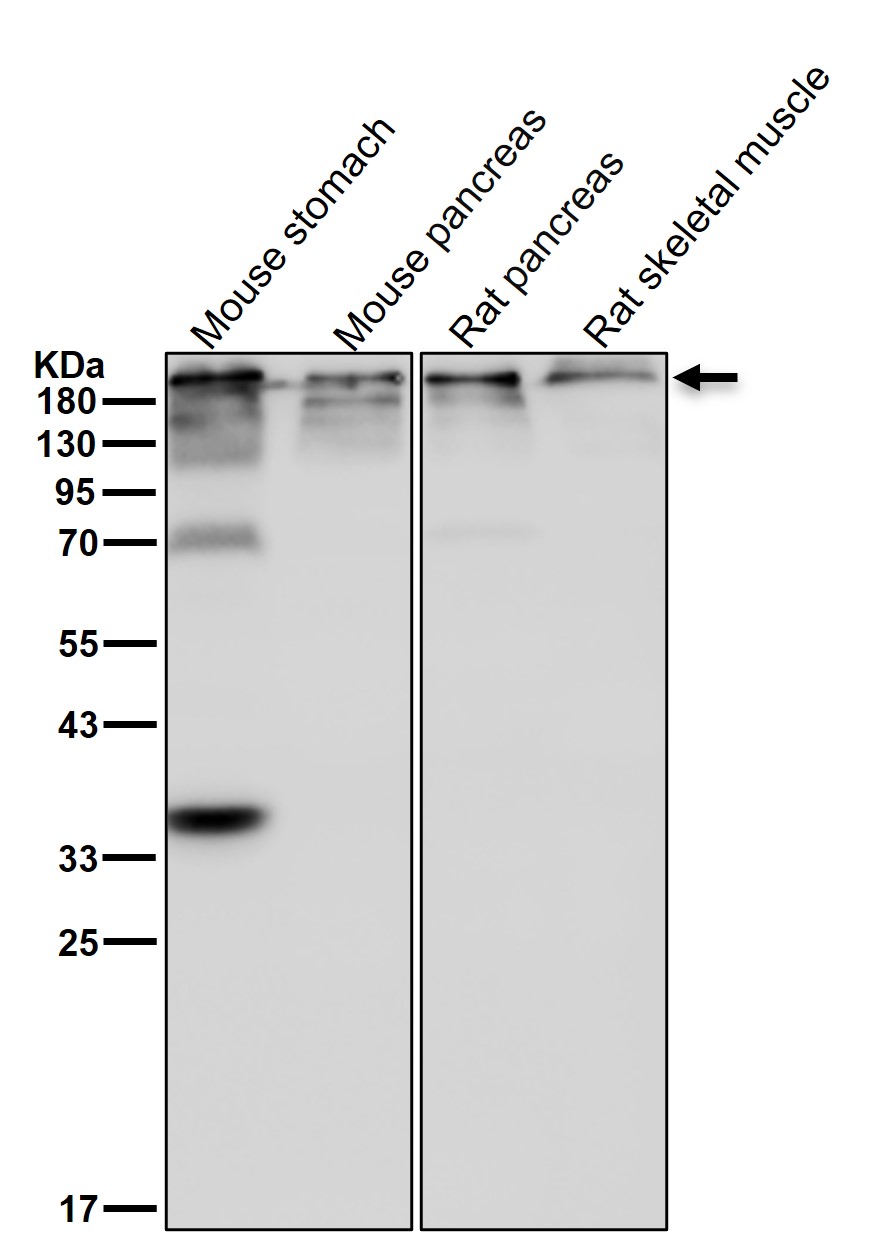 Laminin beta 1 Ab