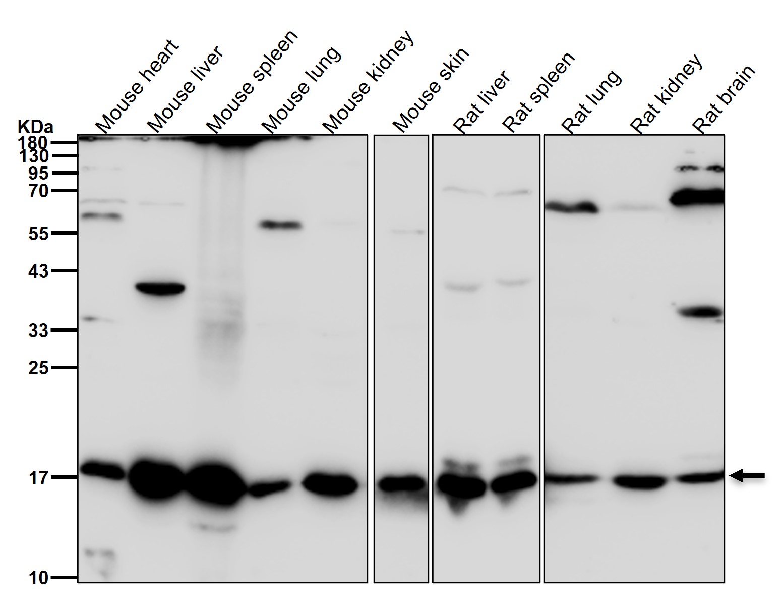 Ferritin light chain Ab