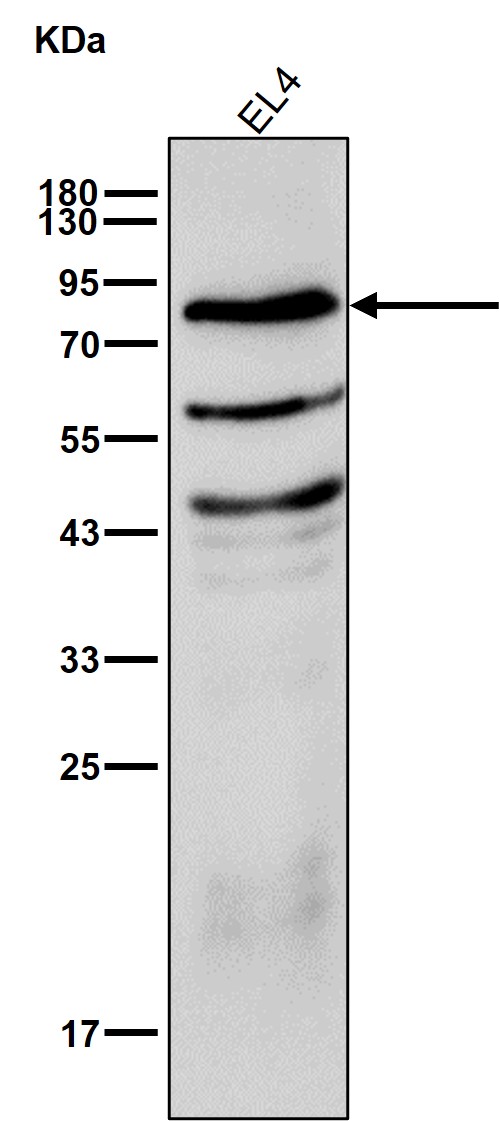 Lymphocyte cytosolic protein 2 Ab