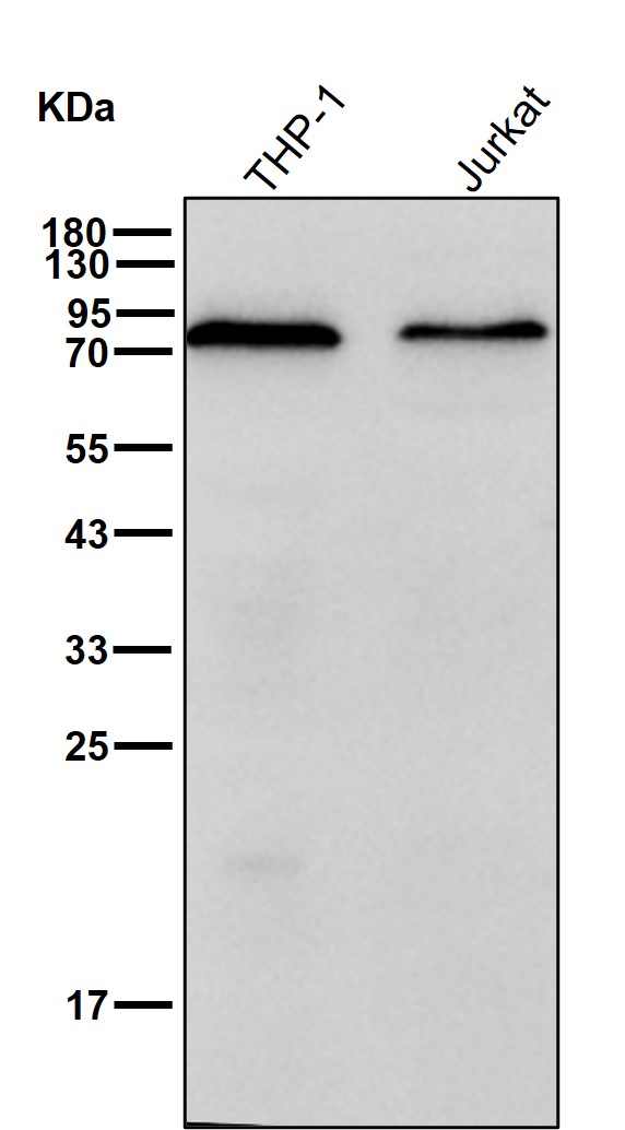 Lymphocyte cytosolic protein 2 Ab