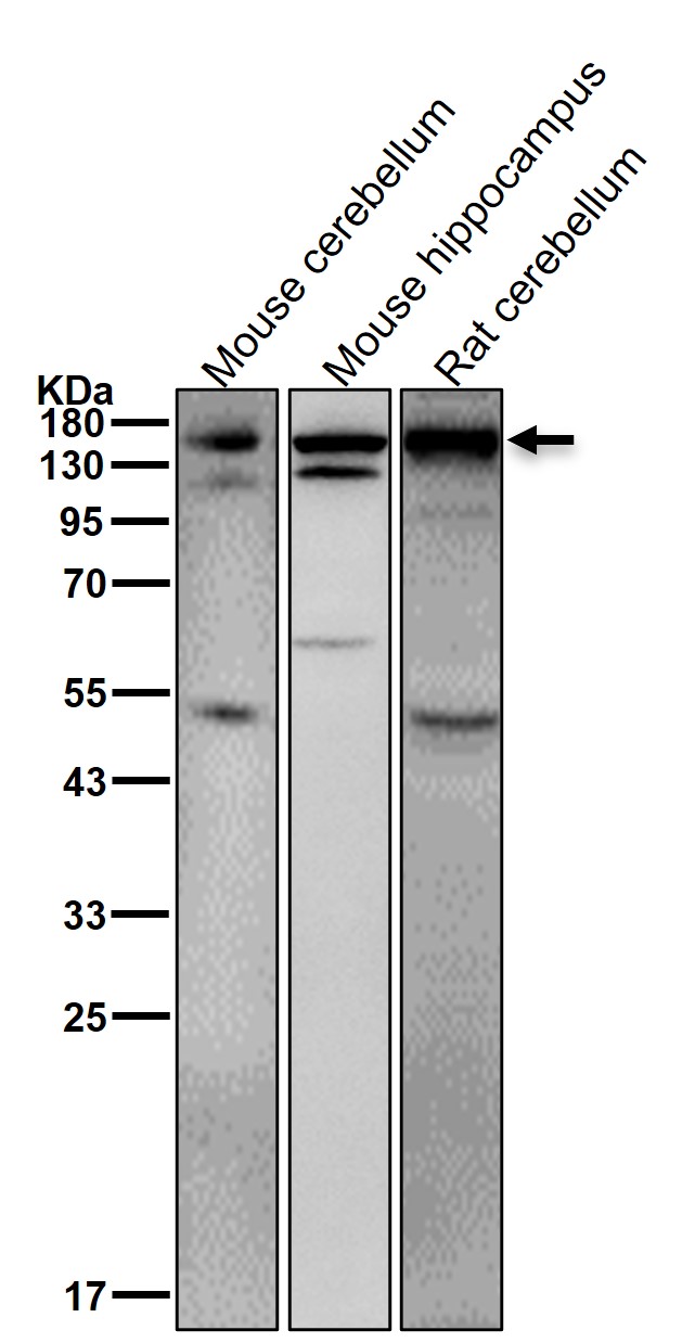 PLCG1 Ab