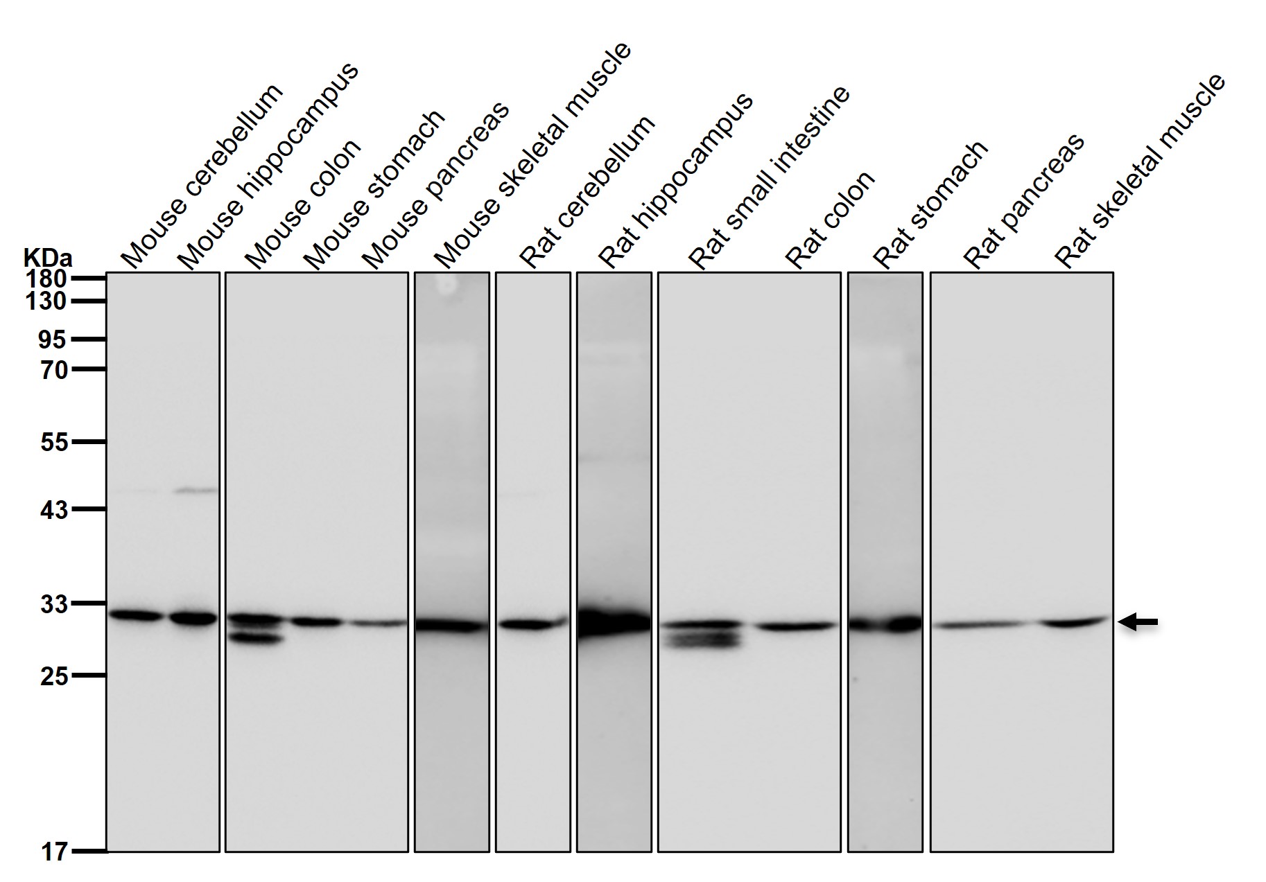 PSMA1 Ab