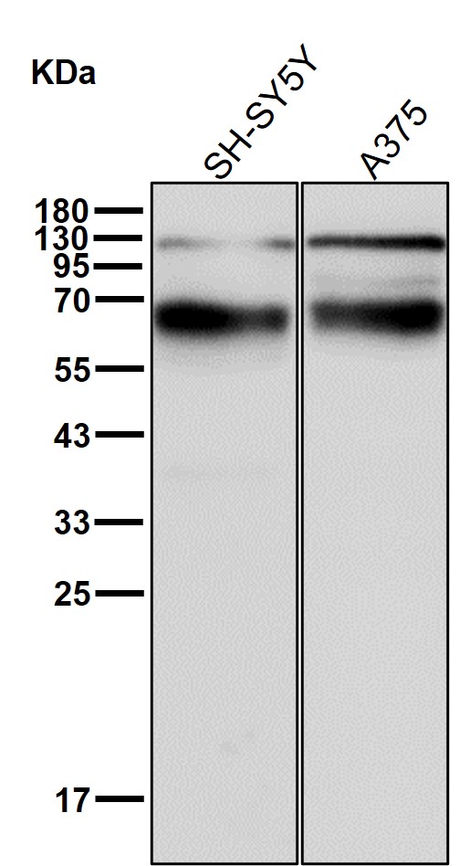 Lysosomal acid GCase Ab