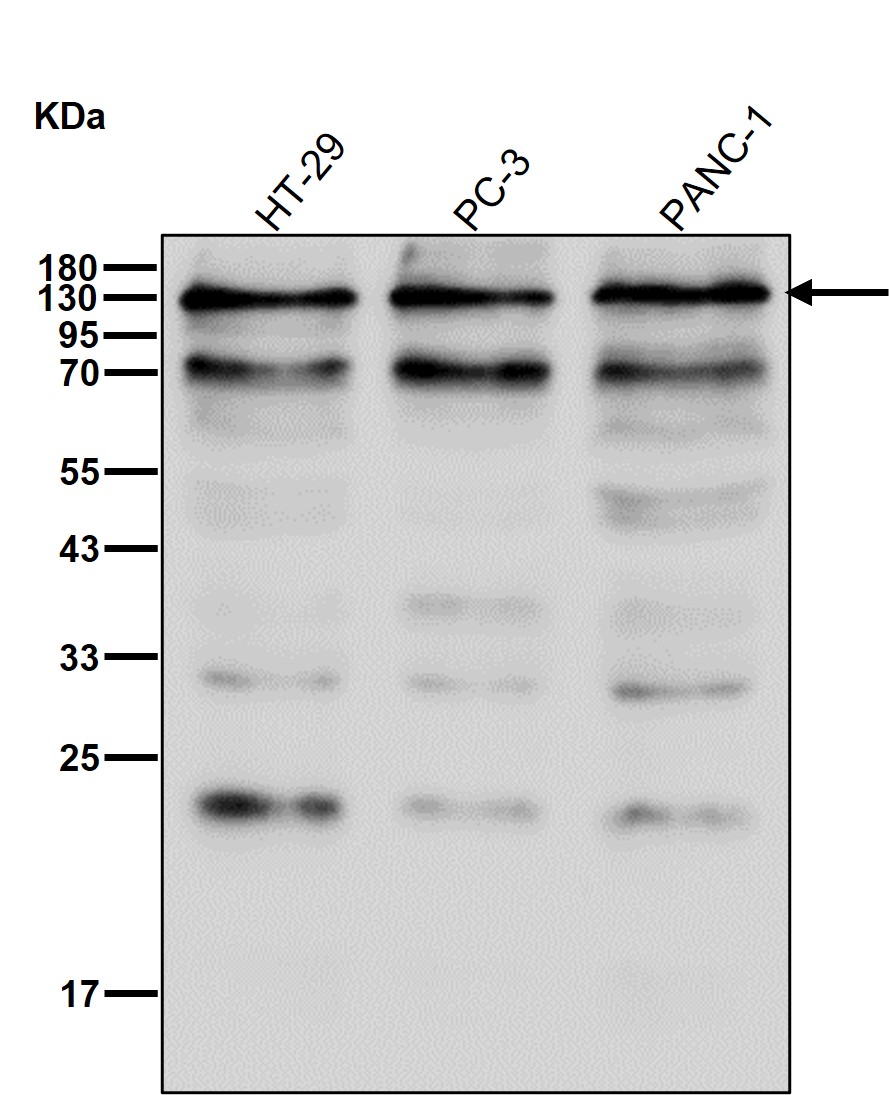 p-alpha Adducin (S436) Ab