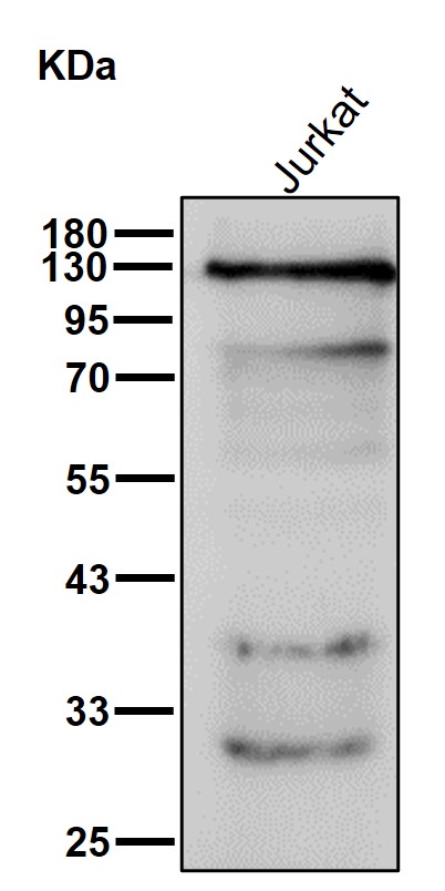 p-alpha Adducin (S436) Ab