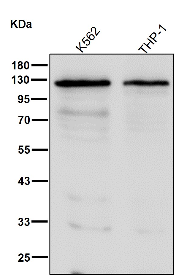 p-alpha Adducin (S436) Ab