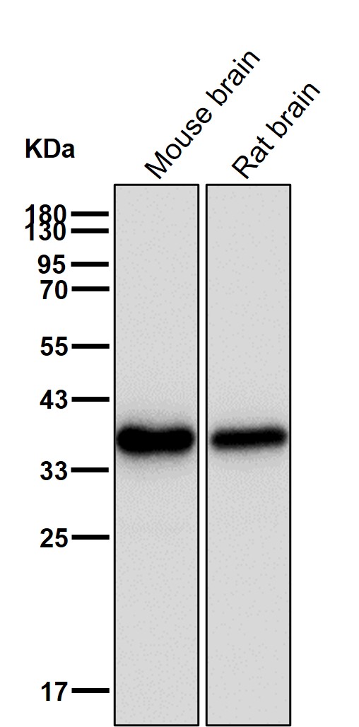 Synaptophysin Ab