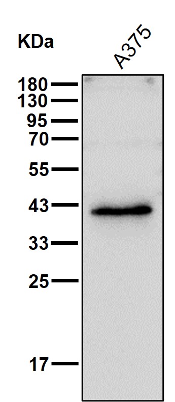 GDF 1 Ab