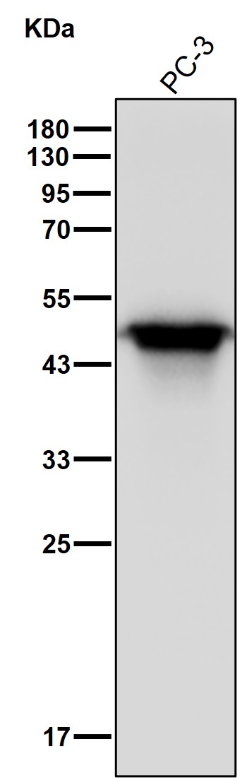 NDRG1 Ab