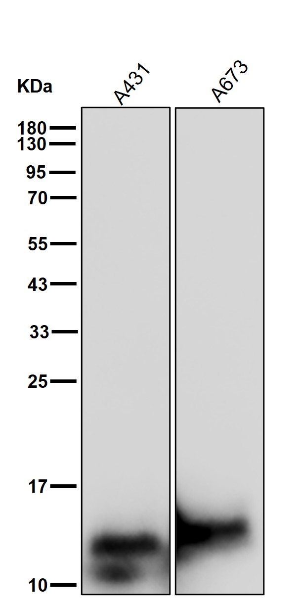 Acetyl-Histone H2B (K5) Ab