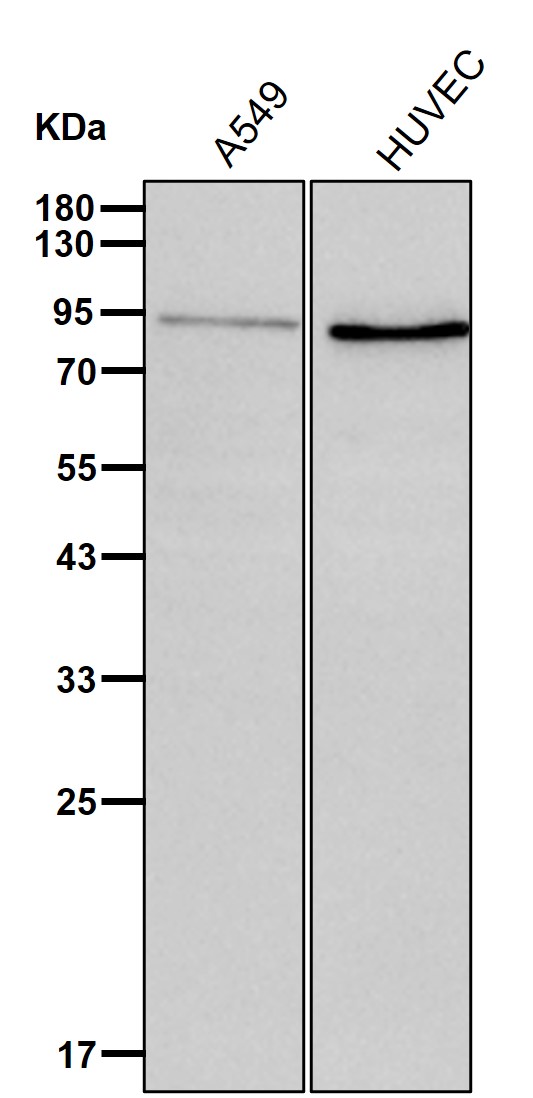 TGM2 Ab