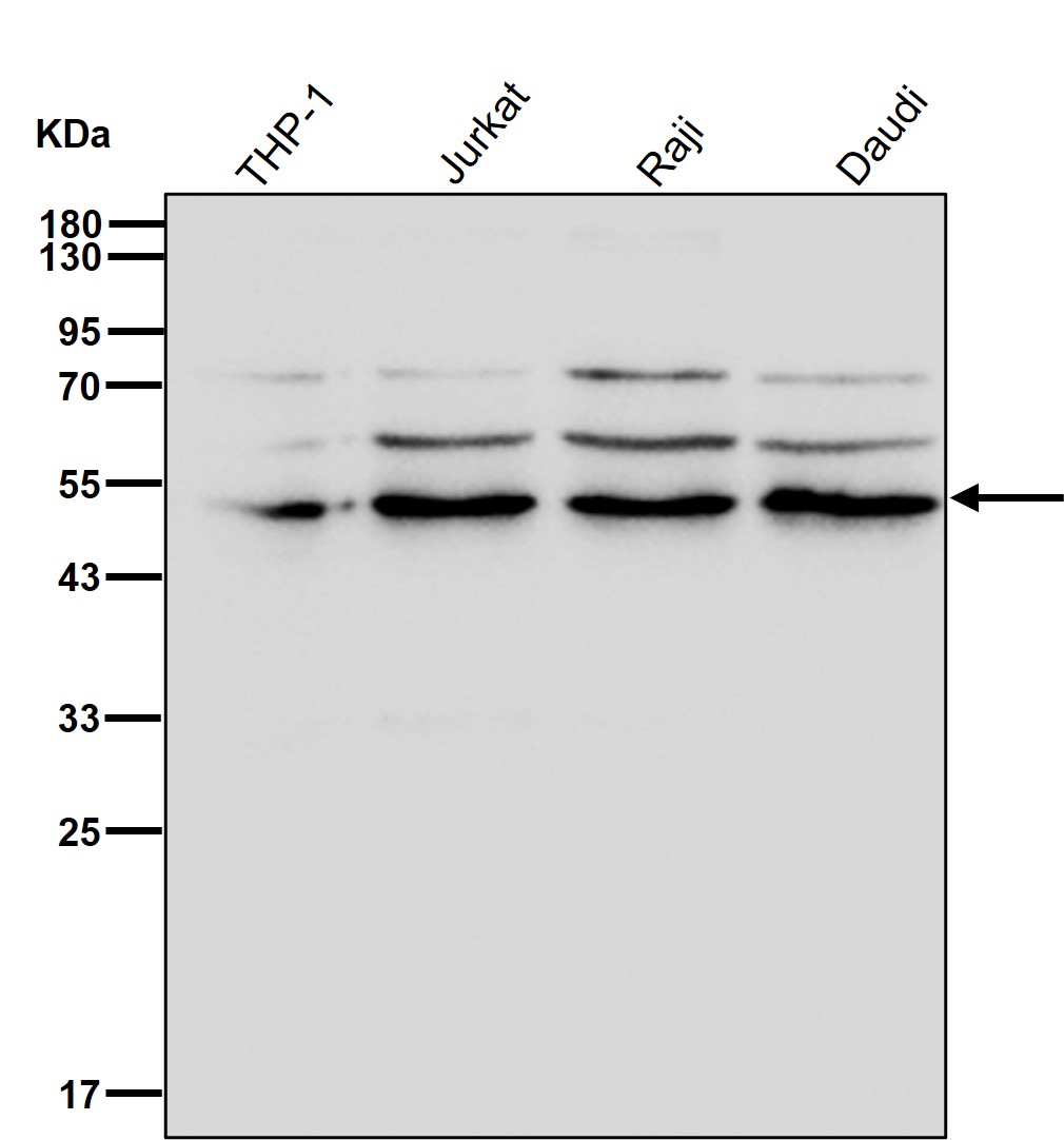 IRF4 Ab