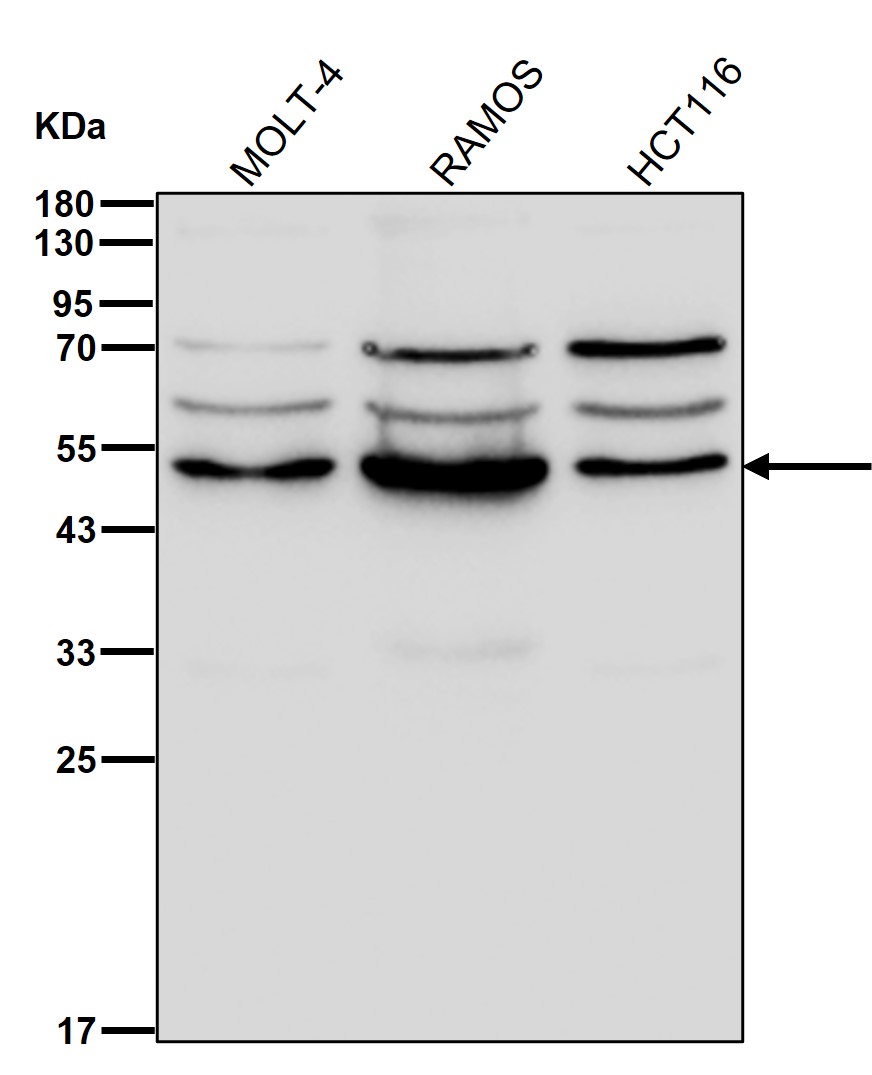 IRF4 Ab