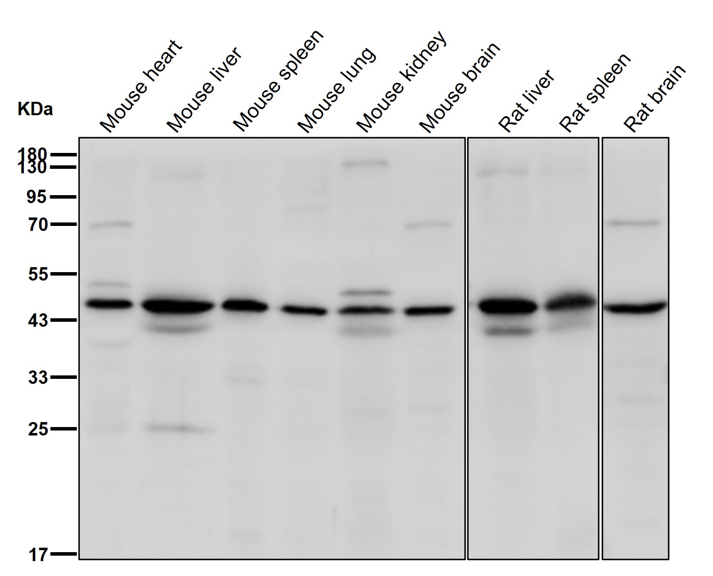 eEF1B gamma Ab