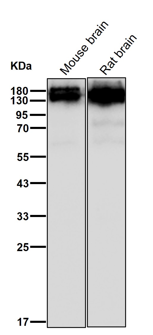 GluN2A Ab