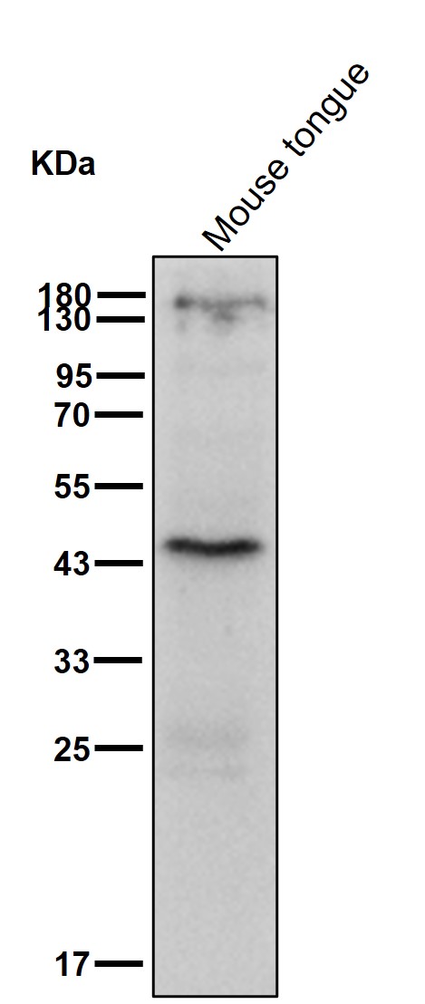 alpha 1 Antichymotrypsin Ab