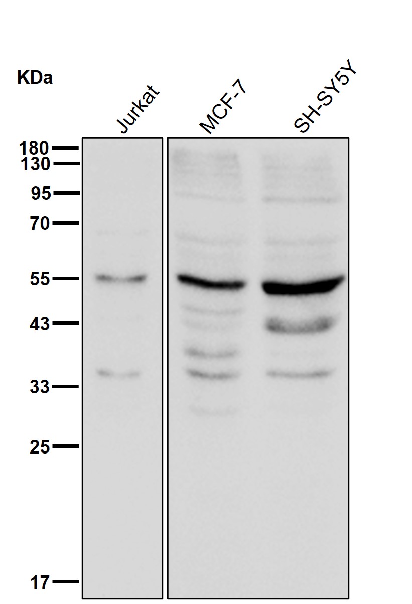 alpha 1 Antichymotrypsin Ab