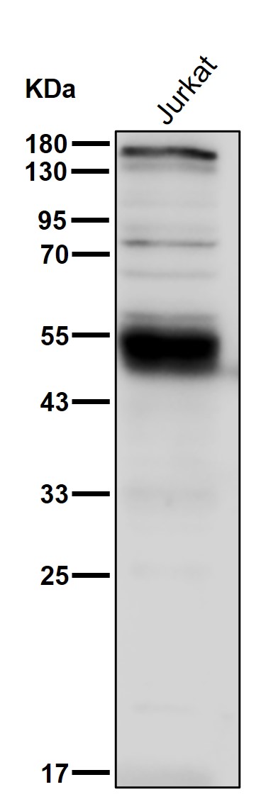 alpha Galactosidase A Ab