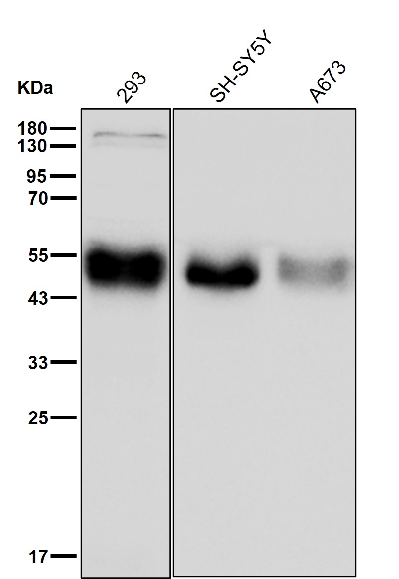 alpha Galactosidase A Ab