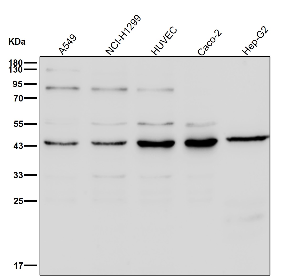 ACAA2 Ab