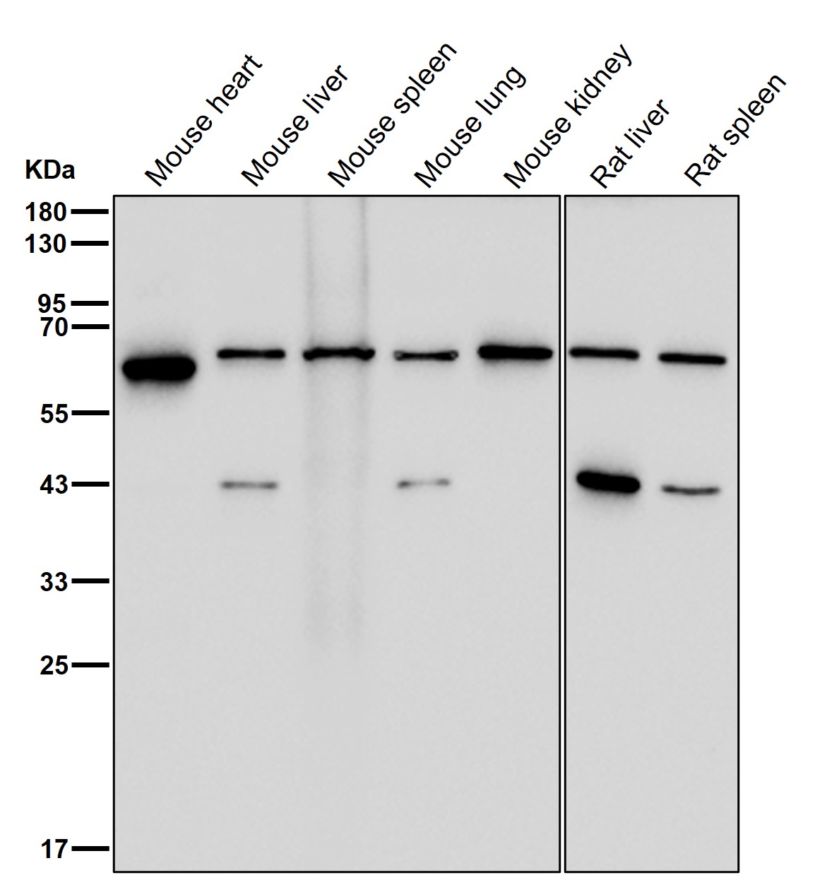 alpha Fetoprotein Ab