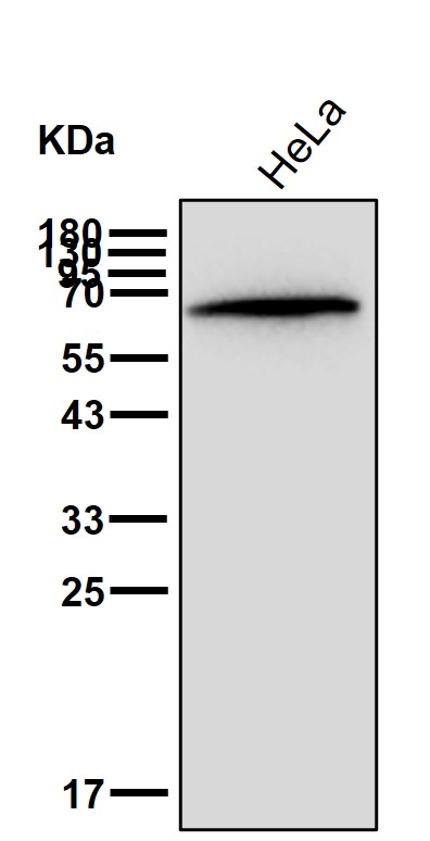 alpha Fetoprotein Ab