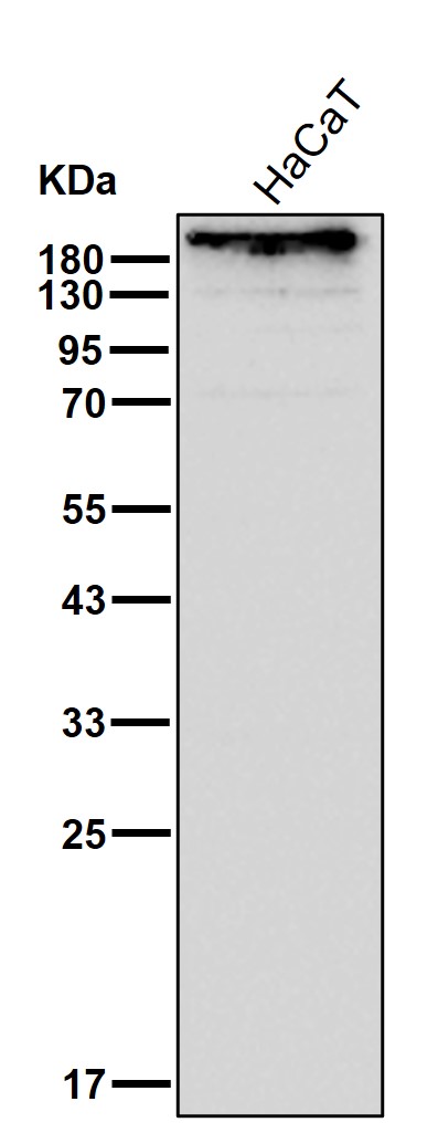 Periplakin Ab