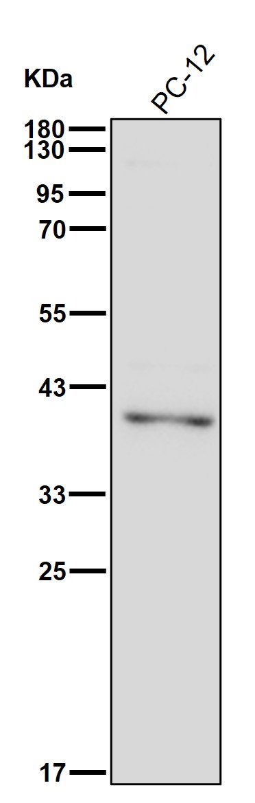 DRG 1 Ab