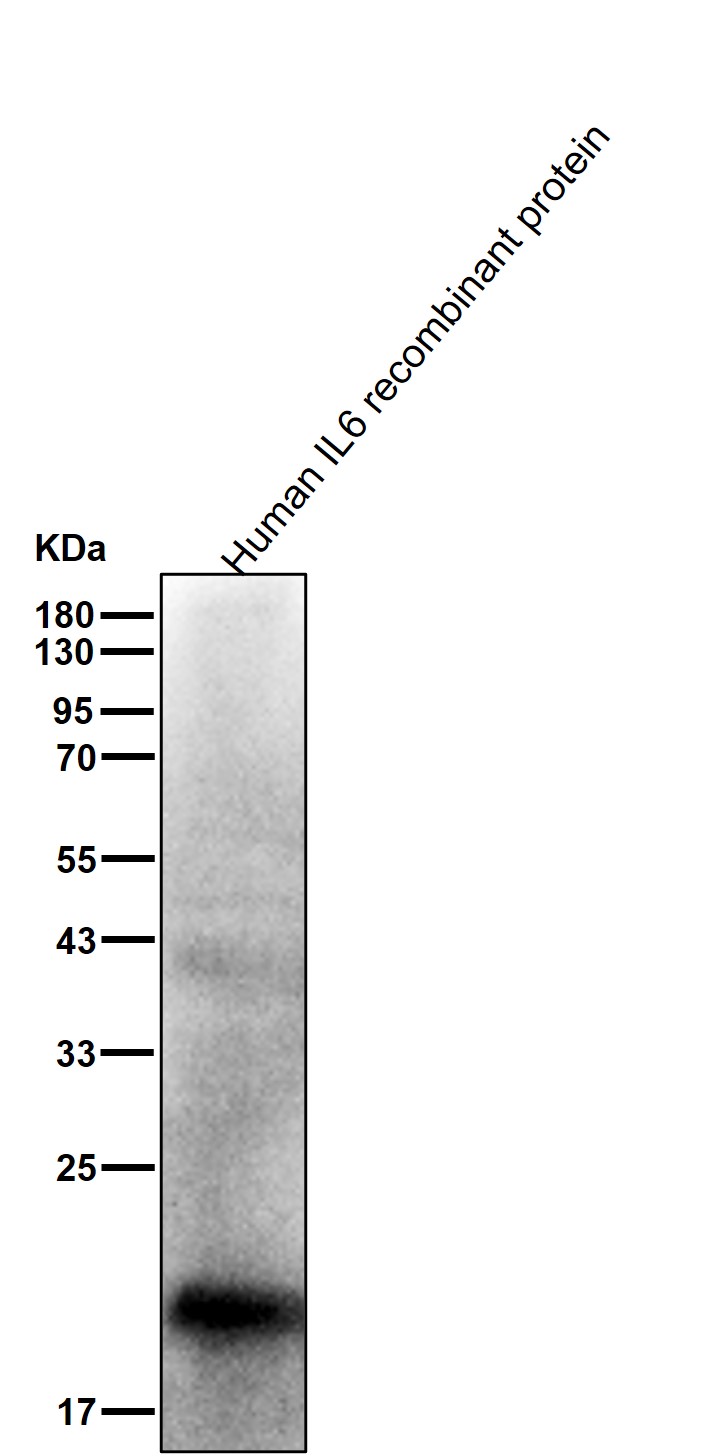 IL 6 Ab