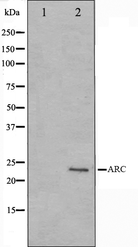 Nucleolar protein 3 Ab