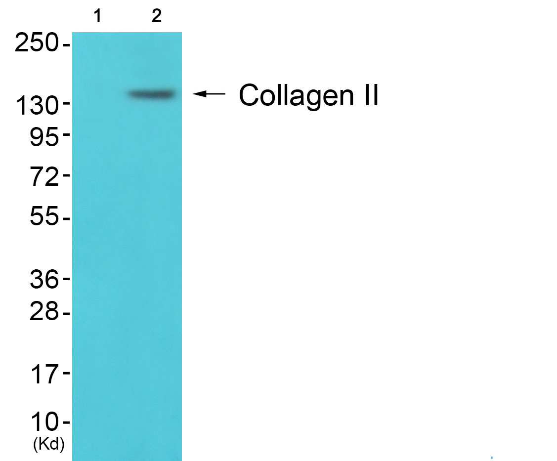 Collagen II alpha 1 Ab