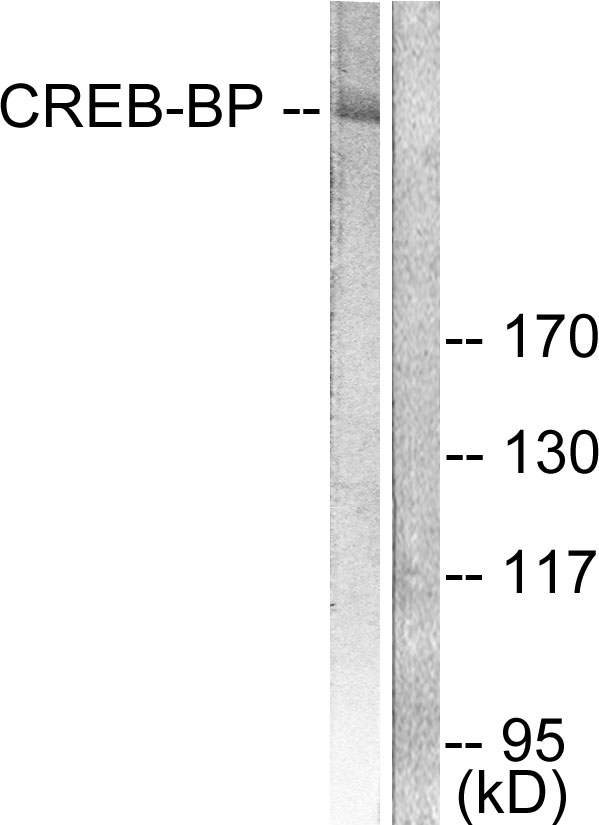 CREB binding protein Ab