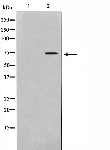 IL 2 receptor beta Ab