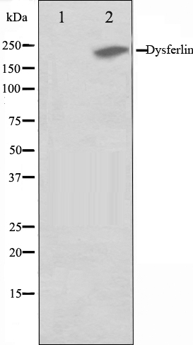 Dysferlin Ab