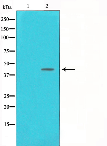 DNA polymerase beta Ab