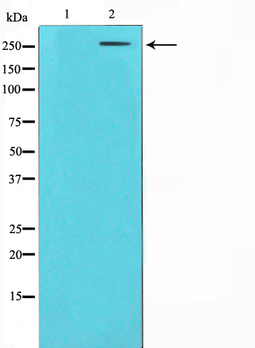 Coagulation factor VIII Ab