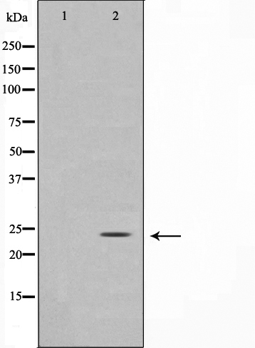 Glucagon Ab