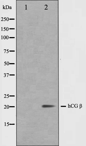 CG beta 3/7 Ab