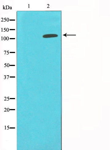 HDAC9 Ab