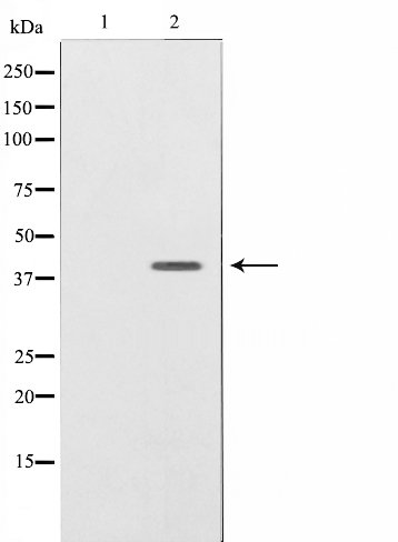 NRG1 isoform 10 Ab