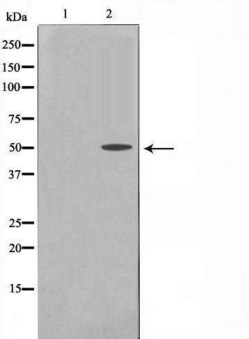 Cytokeratin 16 Ab