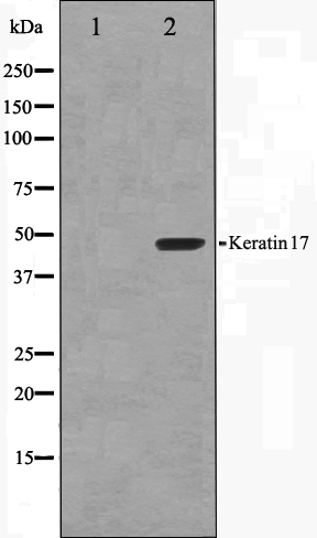 Cytokeratin 17 Ab