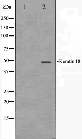 Cytokeratin 18 Ab