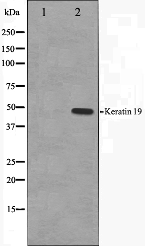 Cytokeratin 19 Ab